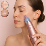 Vacuum Suction Tool with 4 Suction Head (Multi-Color / 1 Set)