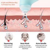 Mini Handheld Vacuum Blackhead Remover – Facial Massage & Spot Lifting (1 Pc)